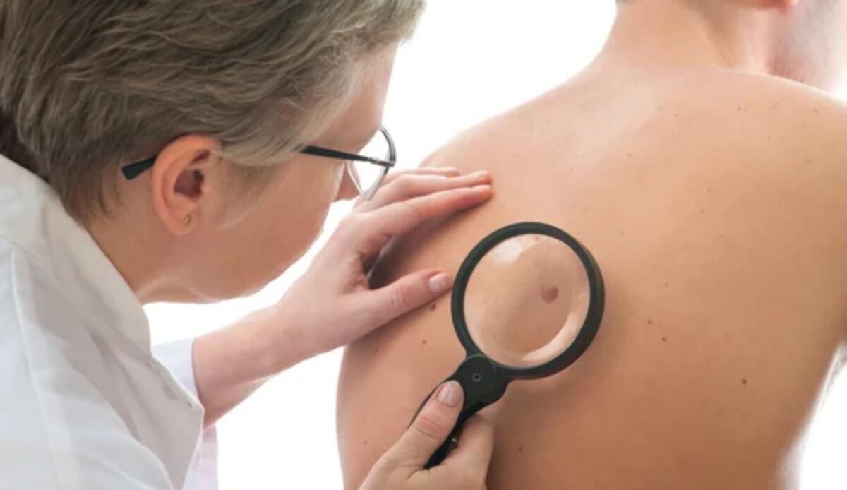 Rischio tumori, secondo un nuovo studio questo alimento potrebbe ritardare la crescita delle cellule tumorali - Illustrazione di una macchia tumorale (Depositphotos FOTO) - www.biomedicalcue.it