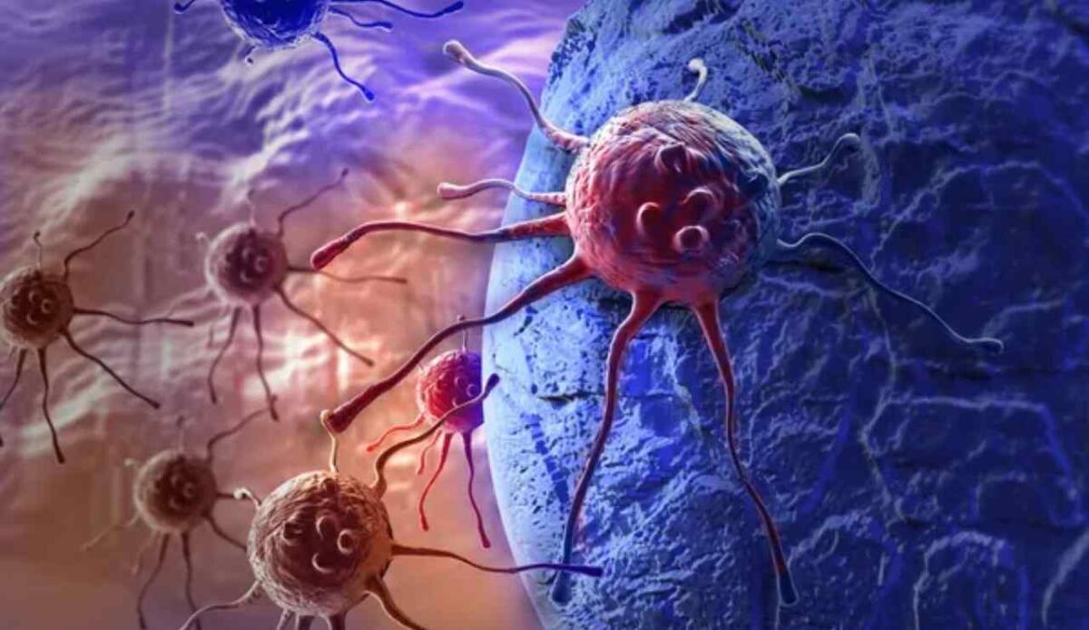 Non fa bene alla salute ma quasi tutto lo bevono: questo prodotto aumenta il rischio di cancro - Illustrazione di cellule tumorali (Depositphotos FOTO) - www.biomedicalcue.it