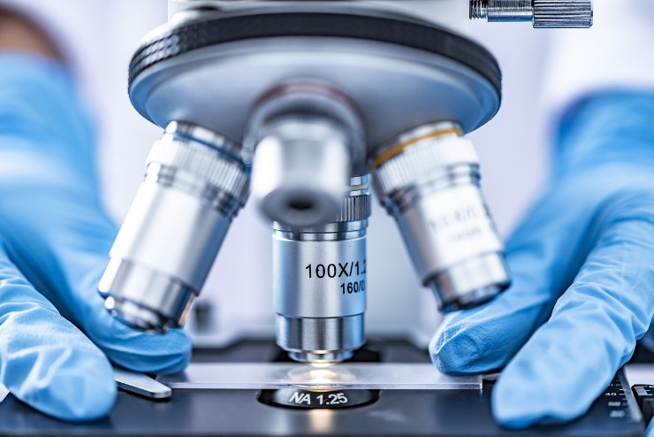 Analisi in laboratorio (Pixabay FOTO) - www.biomedicalcue.it