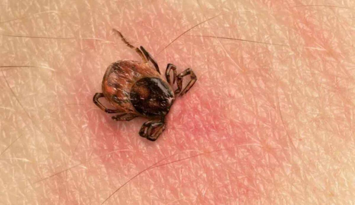 Rickettsiosi da zecche: scoperto un test rapido per diagnosi precoce - Zecca sulla pelle (Depositphotos foto) - www.biomedicalcue.it