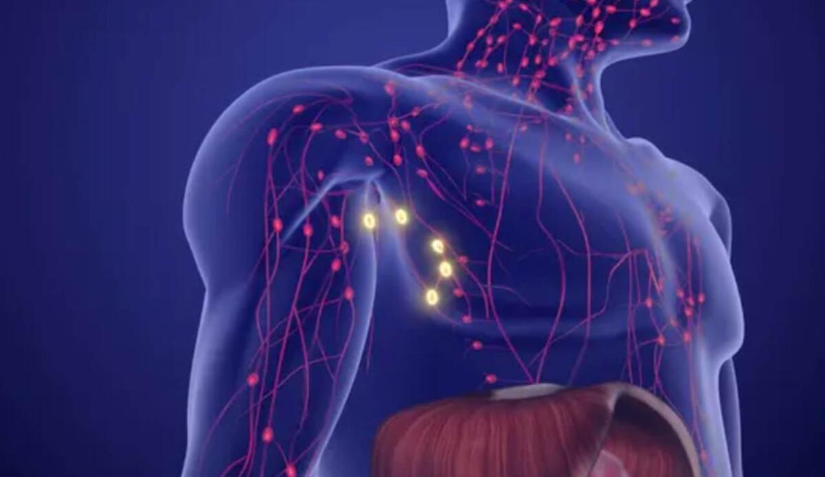 Scoperto il meccanismo molecolare che favorisce la crescita dei linfomi B - Illustrazione di un linfoma (Depositphotos foto)  - www.biomedicalcue.it