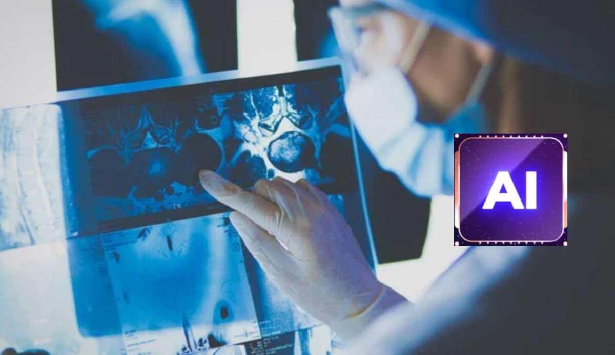 Cancro, l’IA interpreta i dati clinici per terapie oncologiche personalizzate - Lastra di un cancro (Depositphotos foto) - www.systemscue.it