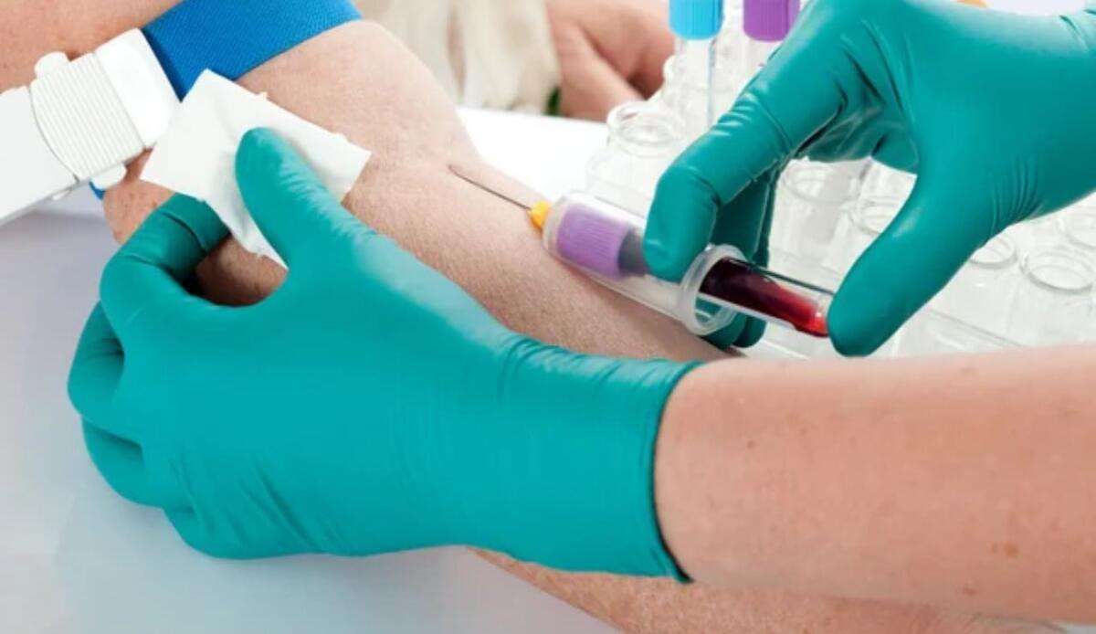 Terapie oncologiche più sicure: un test del sangue rileva effetti collaterali prima del trattamento - Analisi del sangue (Depositphotos foto) - www.biomedicalcue.it