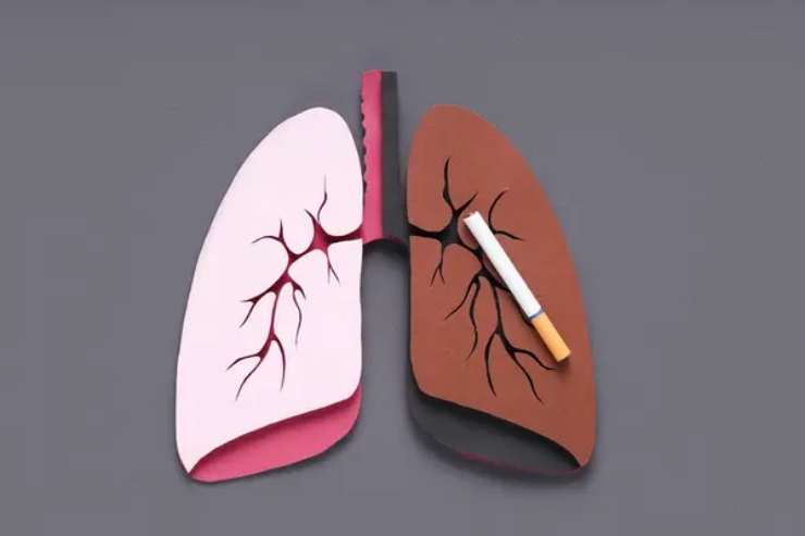 Polmone di un fumatore e non (Depositphotos foto) - www.biomedicalcue.it