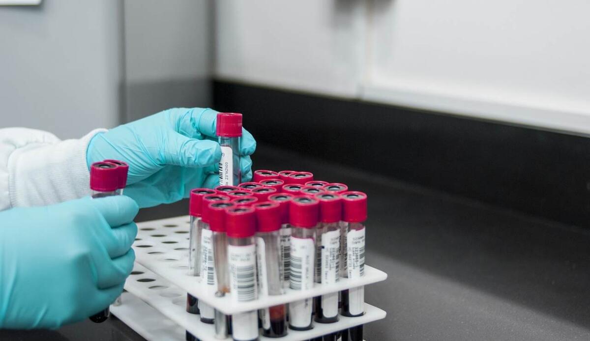 TRIPLE Score, un test del sangue per decidere chi deve assumere aspirina e anticoagulanti - Test del sangue, ecco quello che previene gli infarti (Pixabay) - BiomedicalCUE