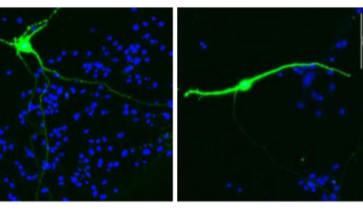 L’inquinamento altera il cervello? Scoperto un meccanismo che può favorire l’Alzheimer - Inquinamento, ecco come influisce sul cervello (scripps.edu) - EnergyCUE