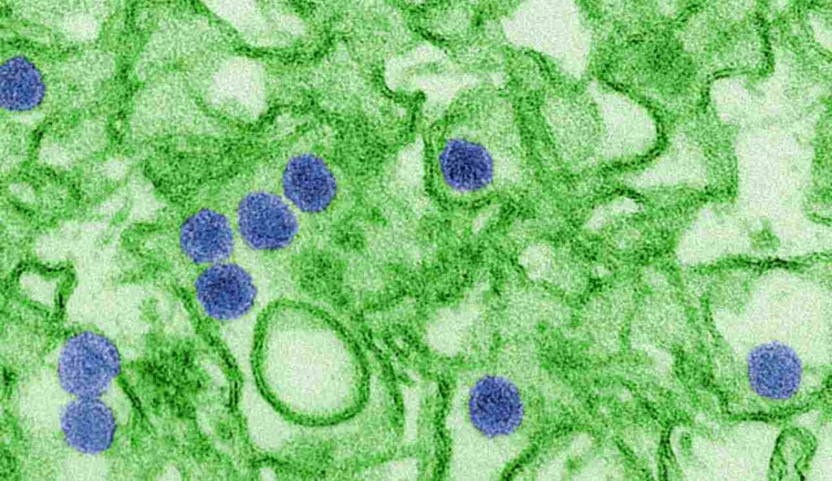 Virus Zika e gravidanza: i nanotubi cellulari favoriscono l’infezione senza attivare il sistema immunitario - Illustrazione di particelle del virus Zika (WIkipedia CDC_ Cynthia Goldsmith FOTO) - www.biomedicalcue.it
