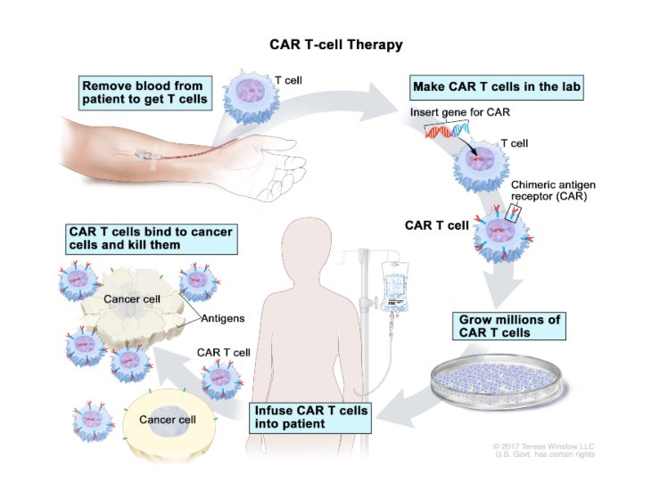 Schema della terapia CAR-T (National Cancer Institute foto) - www.biomedicalcue.it