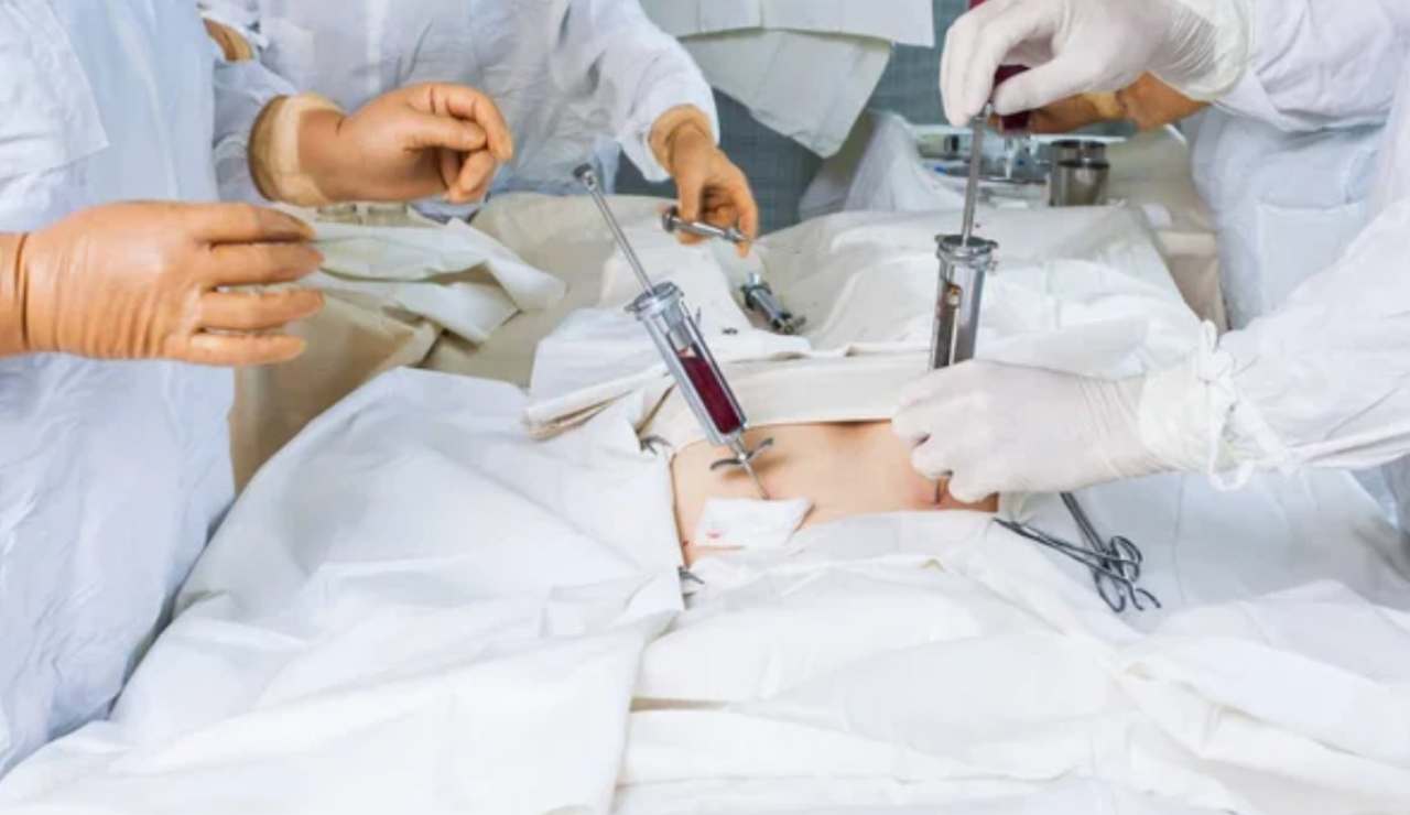 Trapianto di midollo osseo (Depositphotos foto) - www.biomedicalcue.it