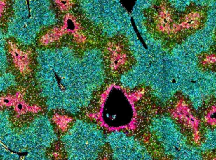 Cellule stellate epatiche (dkfz foto) - www.biomedicalcue.it