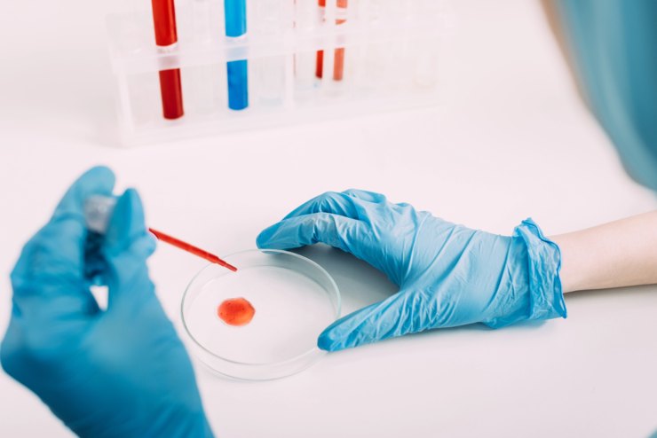 Test sul sangue, un'alternativa alla classica alimentazione per la sindrome dell'intestino irritabile? (DepositPhotos) - BiomedicalCUE