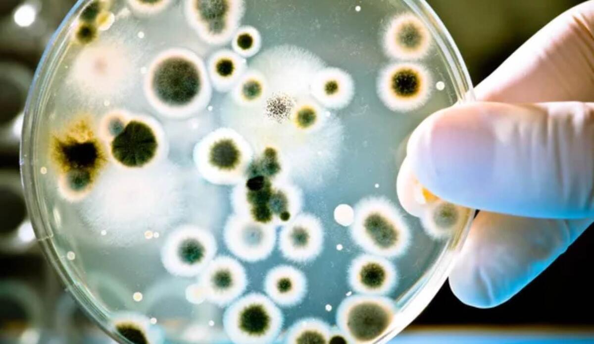 Batteri e condizioni estreme: identificata la proteina chiave della loro resistenza - cultura batterica (Depositphotos foto) - www.sciencecue.it