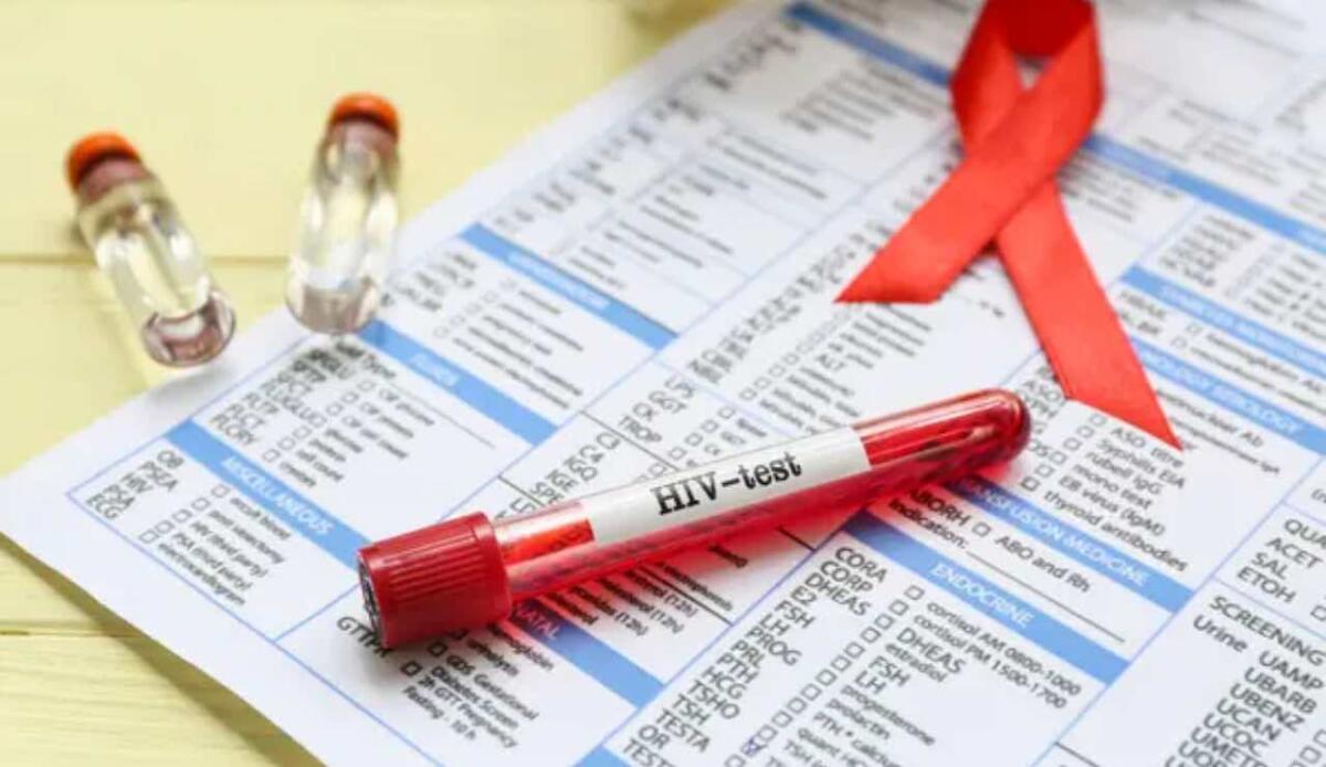 Un passo verso la cura dell'HIV: ricercatori svelano come scoprire le cellule dormienti infette - Test HIV (Depositphotos foto) - www.biomedicalcue.it
