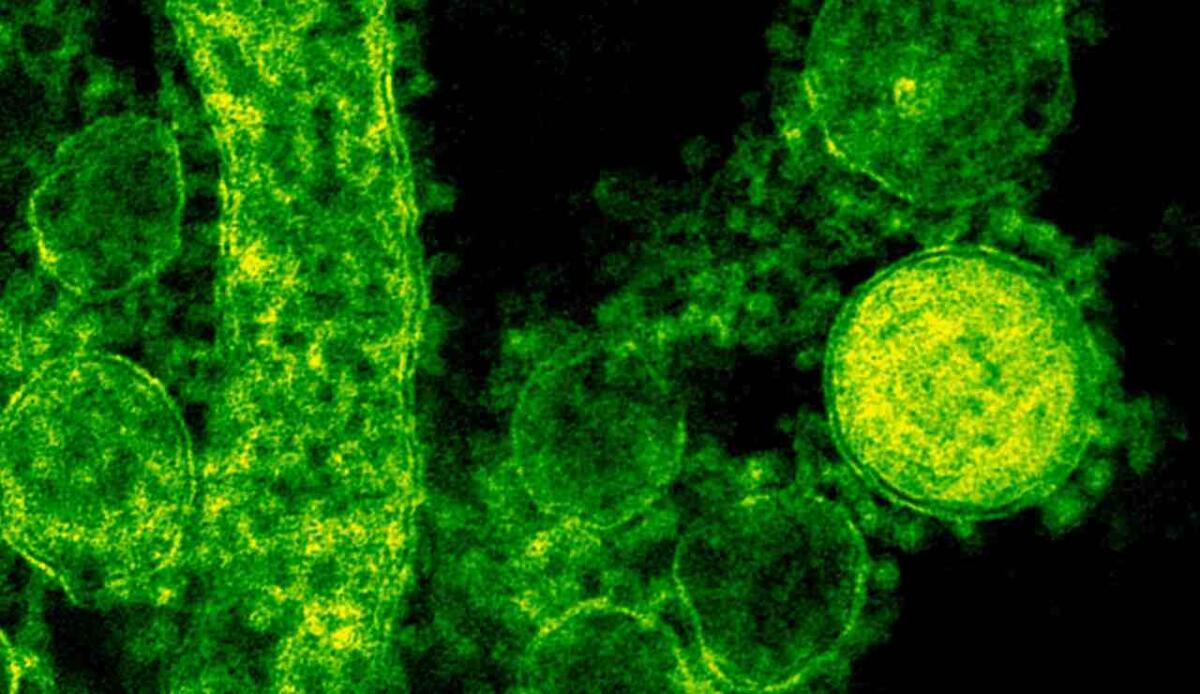 Ricerca pionieristica sui dispositivi cerebrali: i batteri potrebbero essere la causa di infiammazioni e malfunzionamenti - Una ricerca senza precedenti (pexels.com) - www.biomedicalcue.it