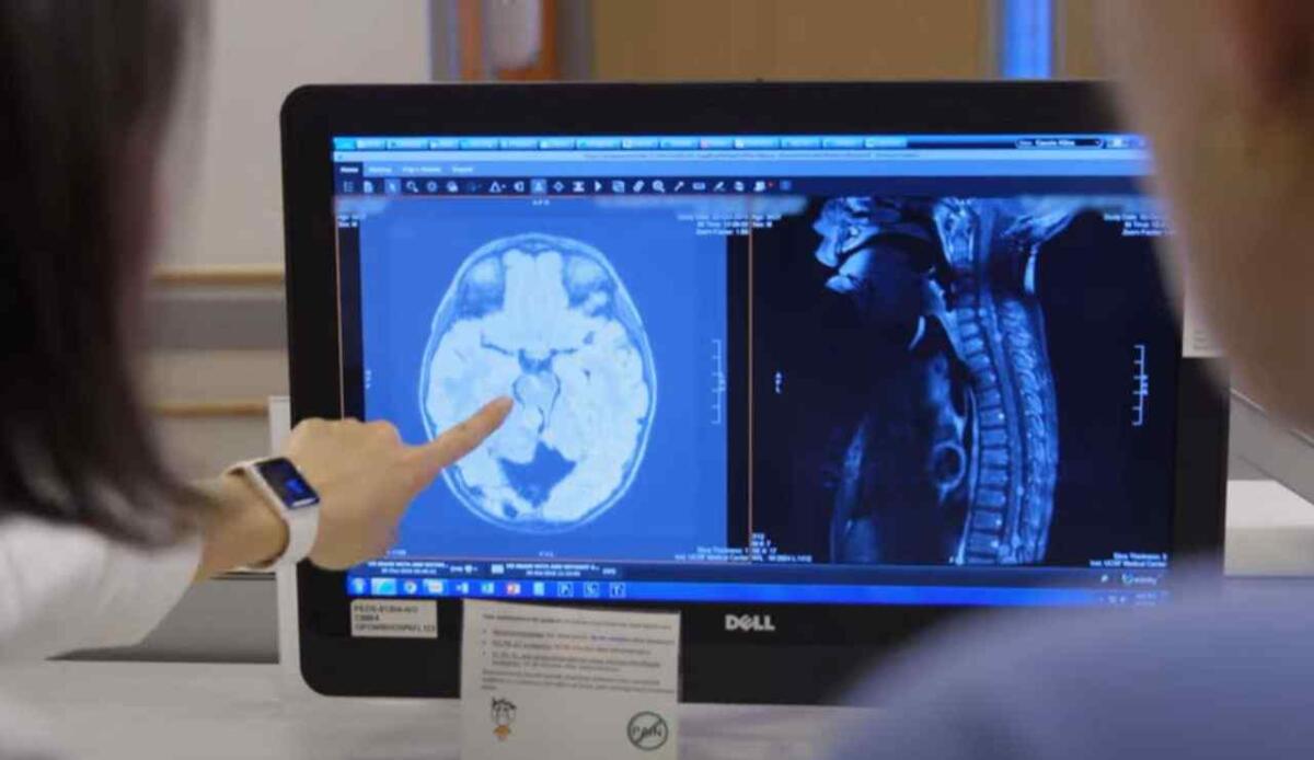 Creata una proteina artificiale che si muove come quelle naturali: nuove prospettive per medicina e ambiente - Osservazione medica (screenshot UCSF Neurosurgery/YouTube) - biomedicalcue.it