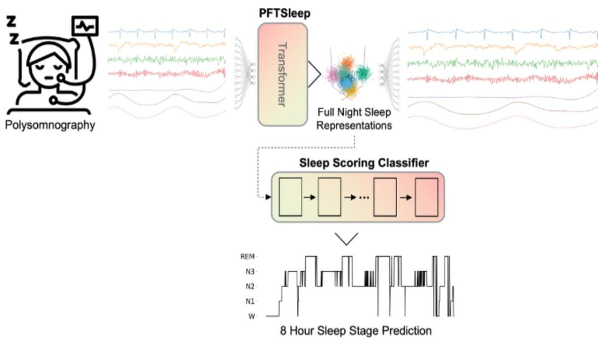 PFTSleep: un modello AI che ottimizza l'analisi del sonno e la diagnosi dei disturbi correlati - PFTSleep, come funziona il modello IA per migliorare il sonno (mountsinai.org) - SystemsCUE