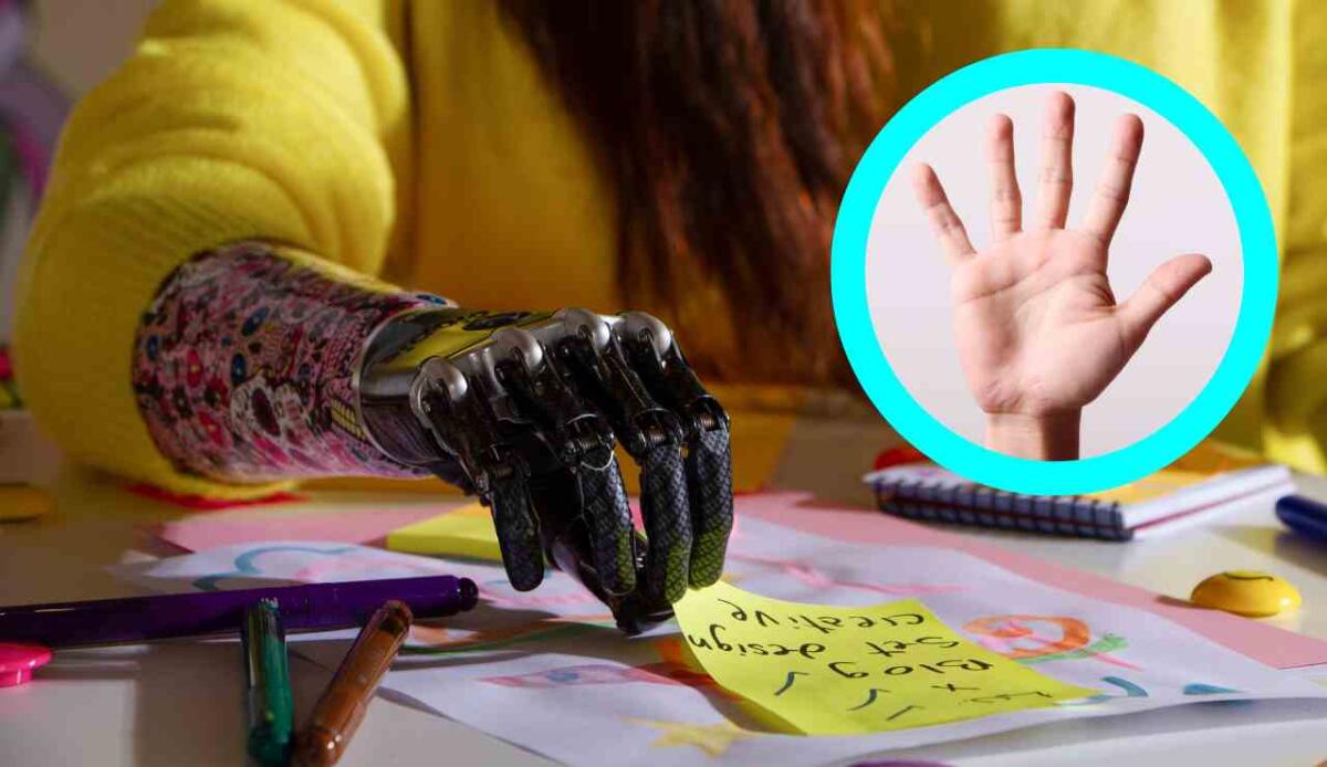 Pelle elettronica in materiale unico dona il senso del tatto ai robot - Protesi della mano (Canva foto) - www.systemscue.it