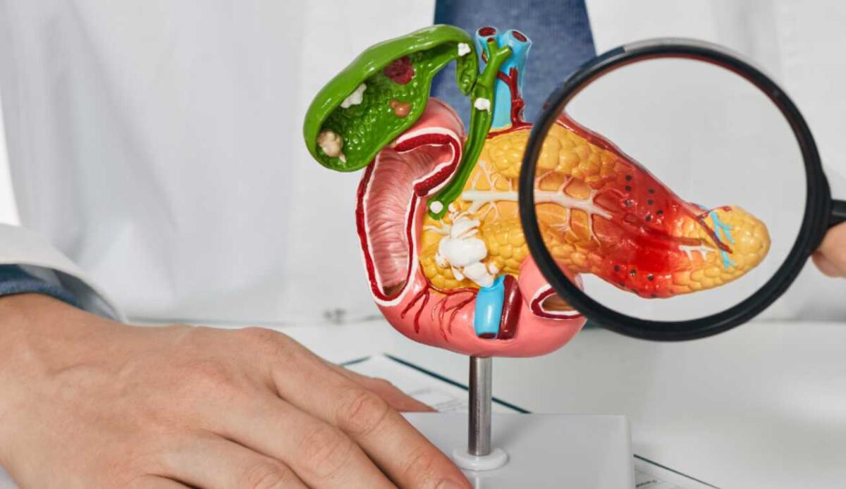 Scoperta la firma genetica del tumore del pancreas più aggressivo - Illustrazione del pancreas (Canva FOTO) - biomedicalcue.it