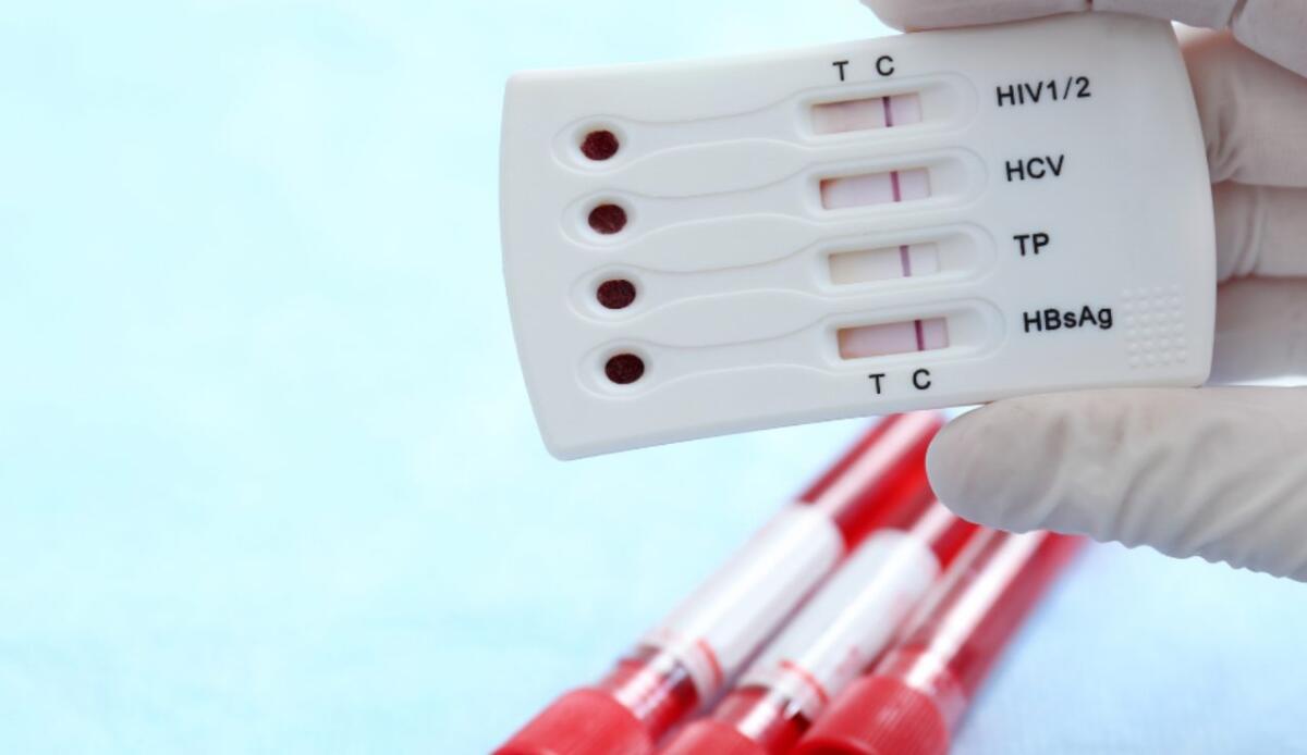 ISS lancia il piano nazionale per sconfiggere epatiti e HIV - Illustrazione del kit dell'HIV (Canva FOTO) - biomedicalcue.it