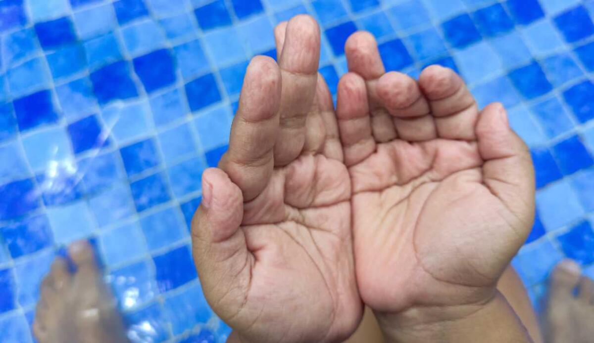 Perché le nostre dita si raggrinziscono nell’acqua? - Illustrazione di mani raggrinzite (Canva FOTO) - sciencecue.it
