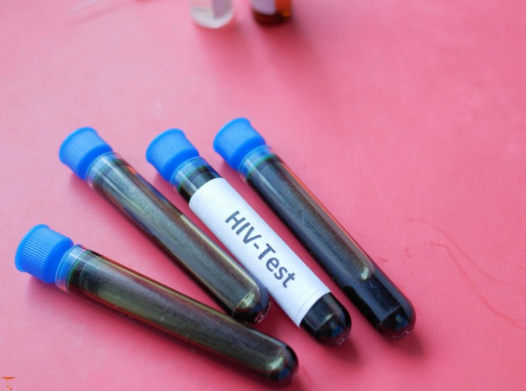 Illustrazione di un test dell'HIV e dell'epatite (Canva FOTO) - biomedicalcue.it