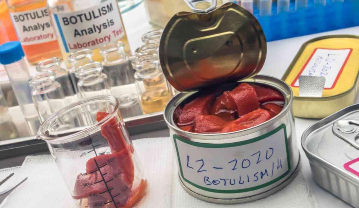 Studio svedese rivela come il botulino attraversa l’intestino: nuove prospettive per terapie più efficaci - Illustrazione dell'analisi del botulismo (Canva FOTO) - biomedicalcue.it