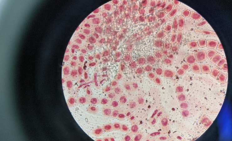 Cellule staminali (Canva foto) - www.biomedicalcue.it