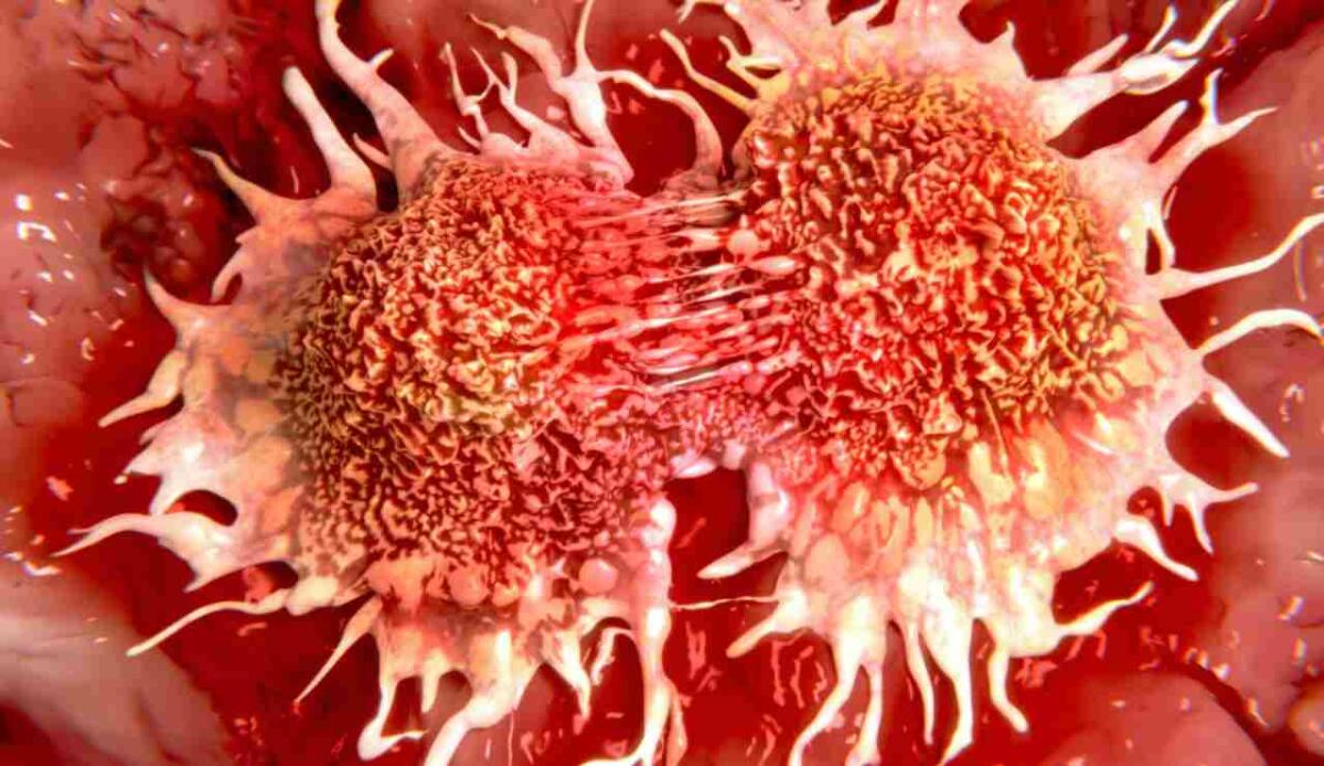 Scoperta in Italia una tecnologia ottica per distinguere cellule tumorali da sane con precisione estrema - Illustrazione di una cellula tumorale (Canva FOTO) - biomedicalcue.it