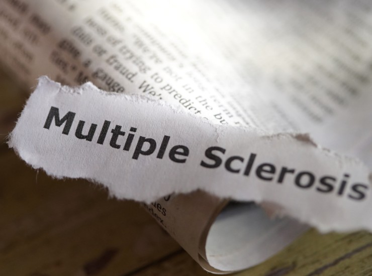 Illustrazione di un pezzo di giornale (Canva FOTO) - biomedicalcue.it
