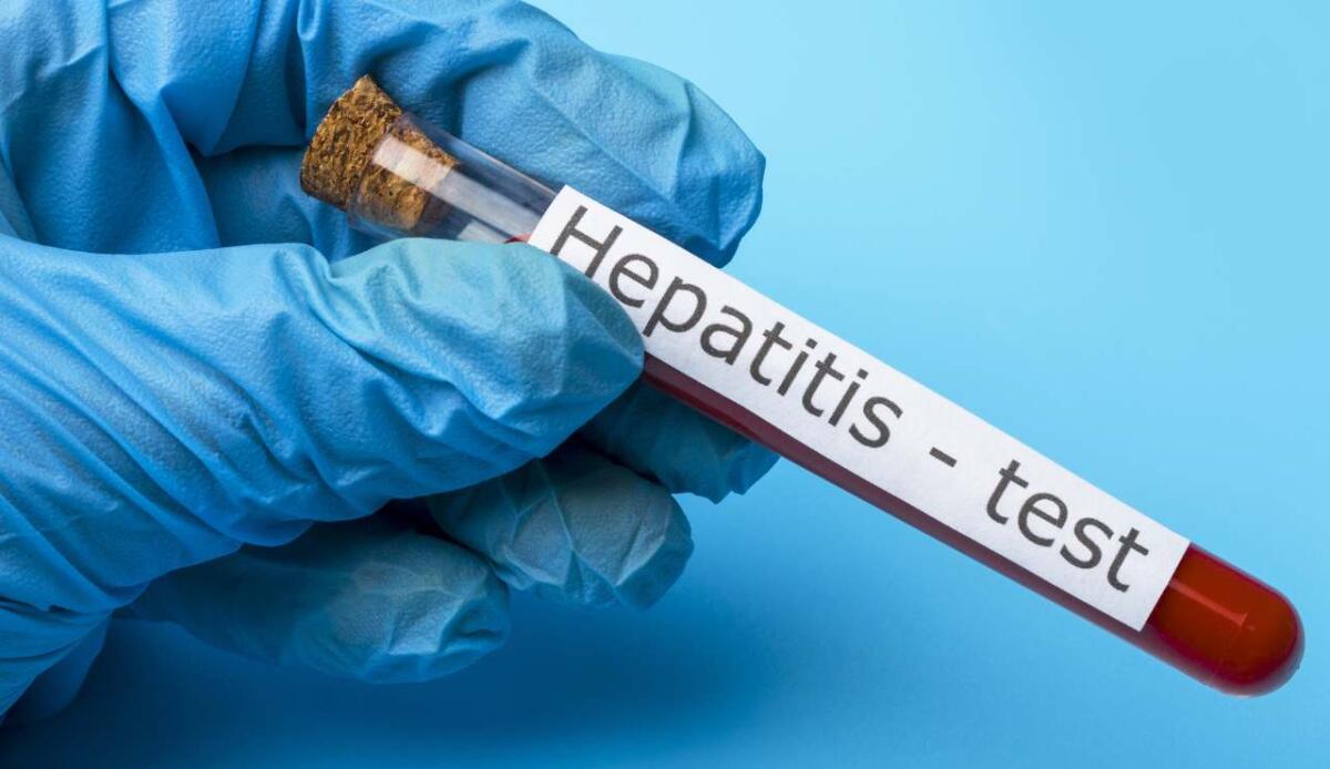 Il test da 15 minuti per l’epatite C: una svolta nella diagnostica molecolare rapida - 