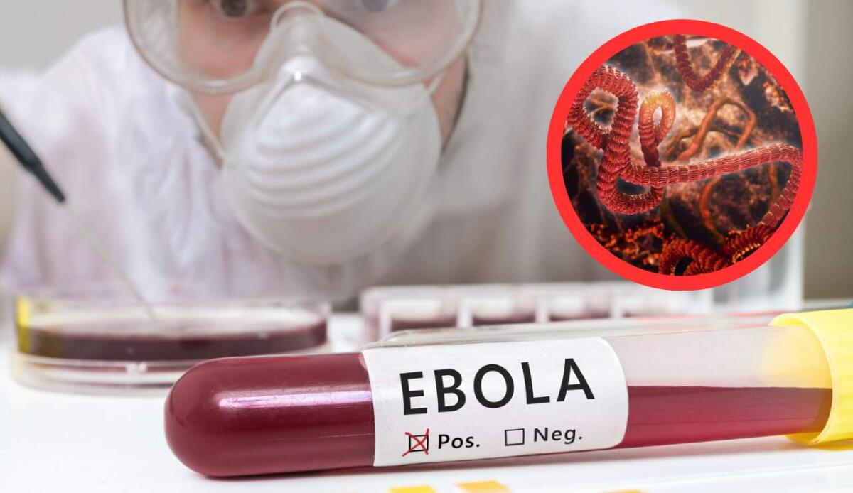 Malattia da virus Ebola: virologia, patogenesi, diagnosi, trattamento e storia epidemica - 