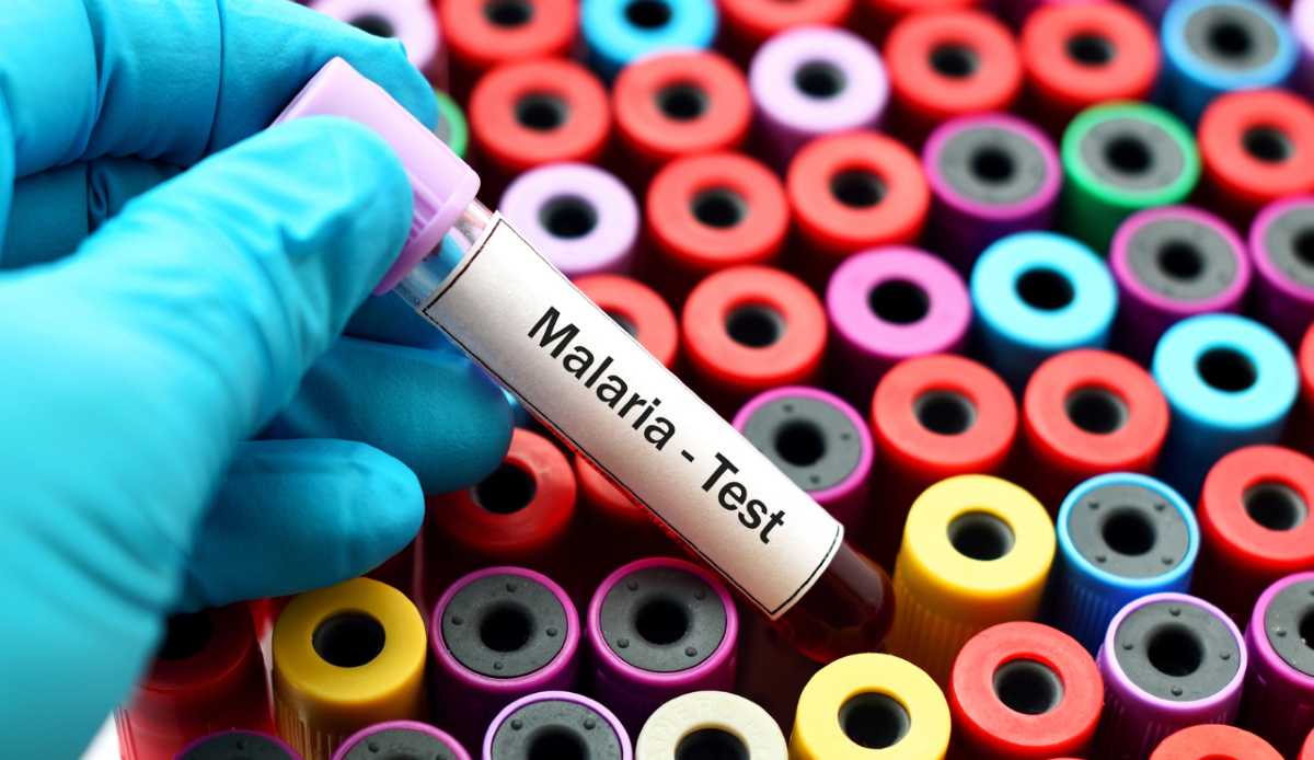 Malaria, il genoma svela resistenze che la clinica non vede - Canva