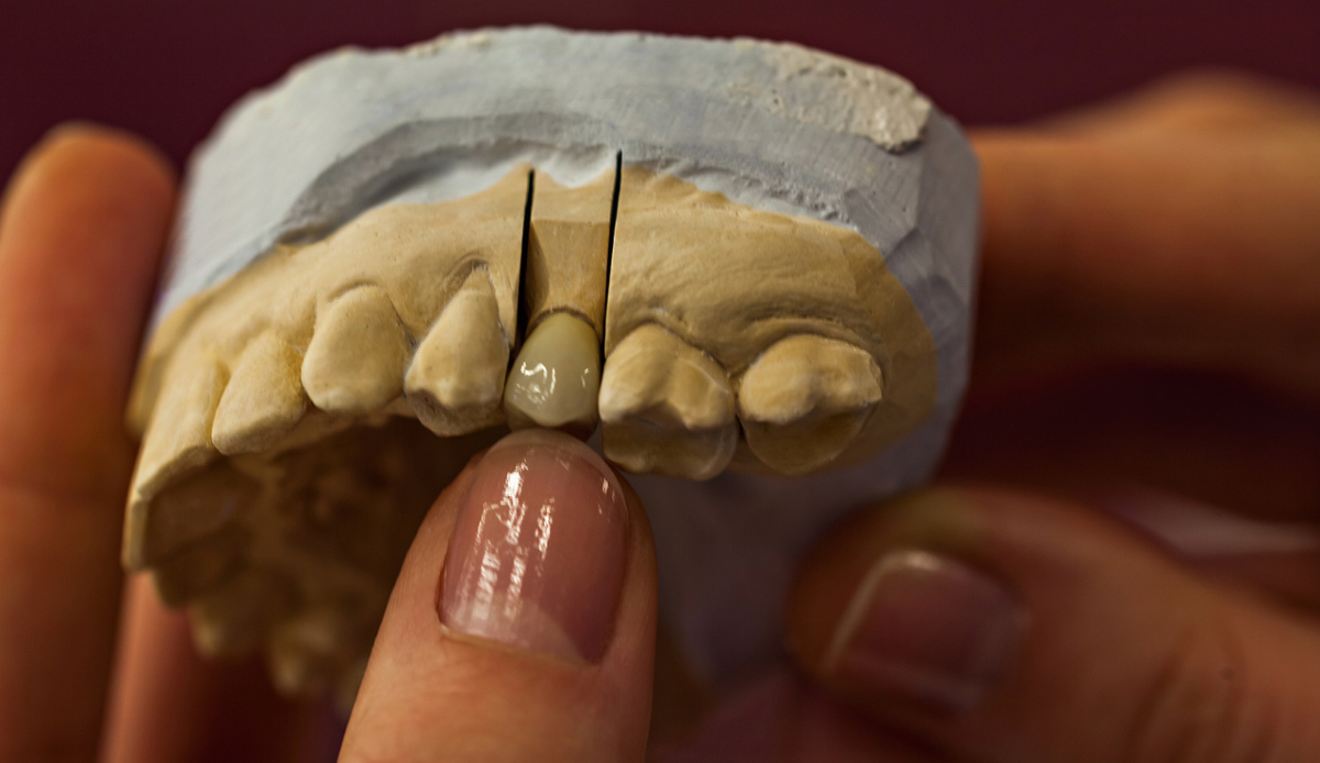 Tracce di sostanze psicoattive in denti vecchi di 25.000 anni fa - 