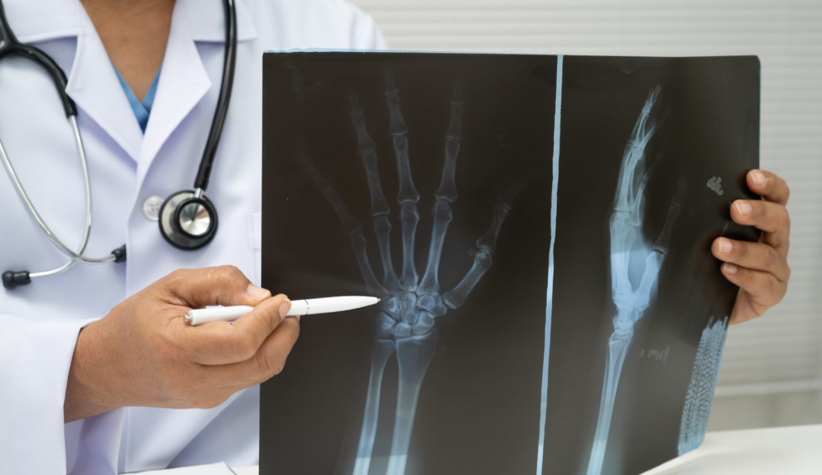 Come un algoritmo legge una radiografia meglio dell'occhio umano - Canva