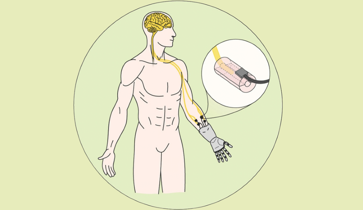 Un neo-muscolo da laboratorio è stato collegato a un nervo durante un test preclinico - 