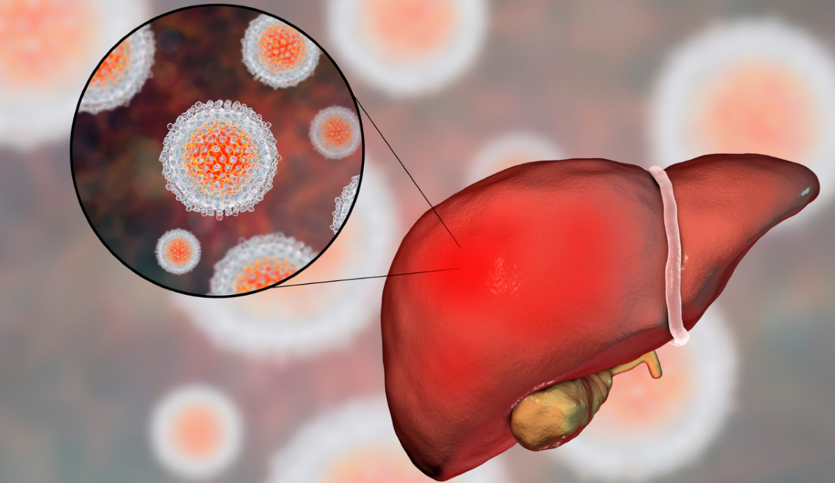 Epatite B: l'editing epigenetico spegne il virus nei topi - Canva
